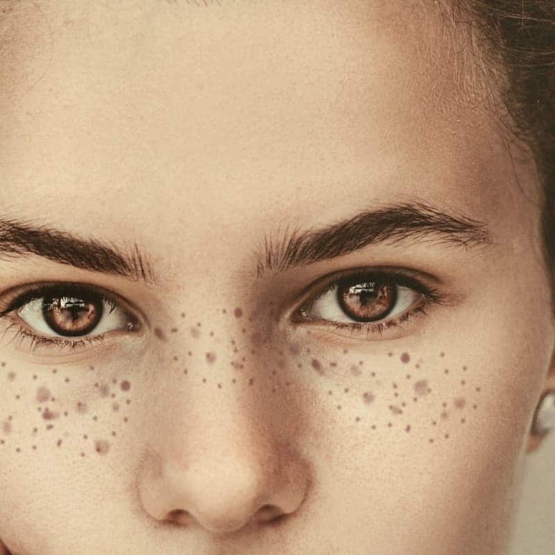Skin texture in daylight