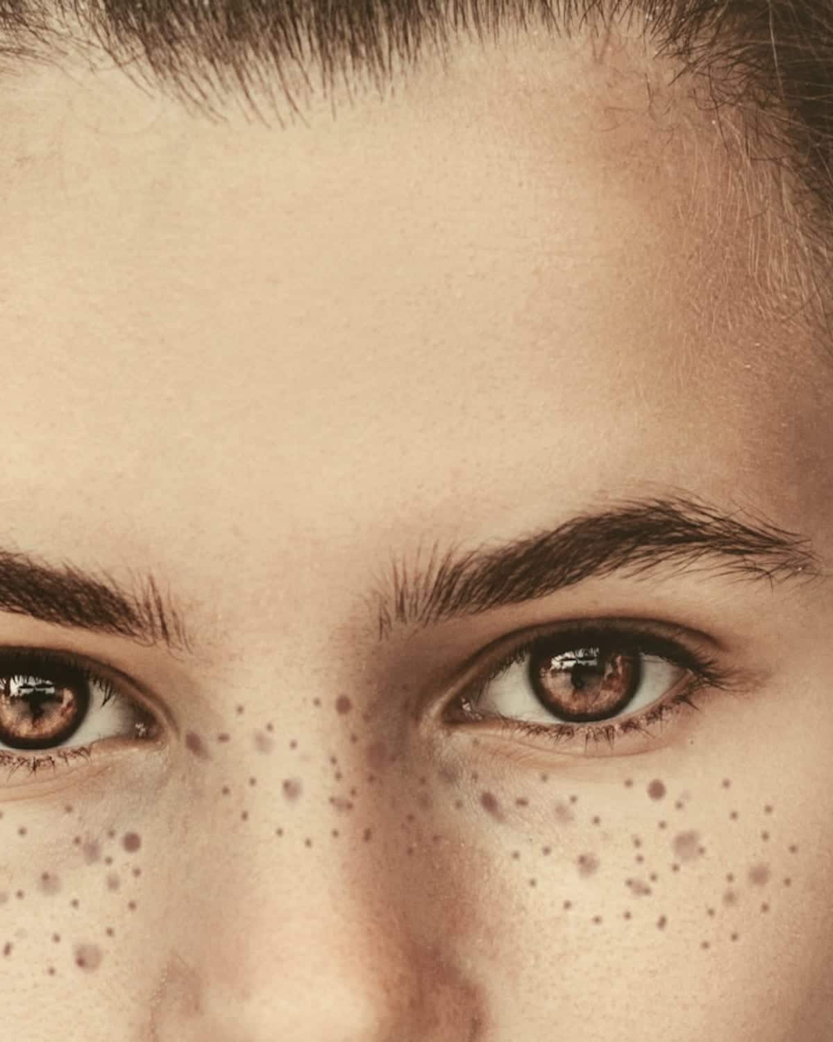 Pico Laser · Pigment and Tone · 2