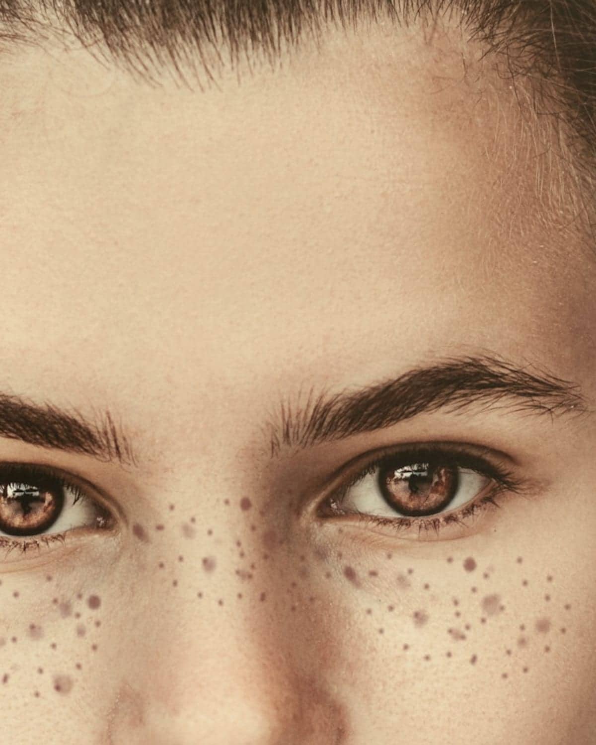 Pico Laser · Pigment and Tone at PRAOW Clinic